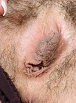 atk hairy